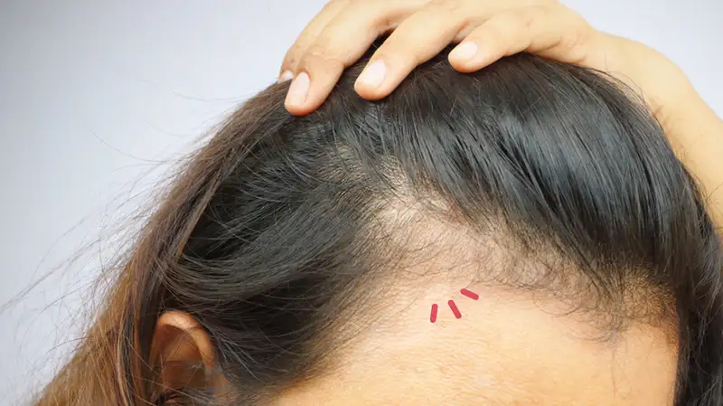 Tips Menumbuhkan Rambut dalam 1 Bulan: Bukan Mitos, Tapi Butuh ...